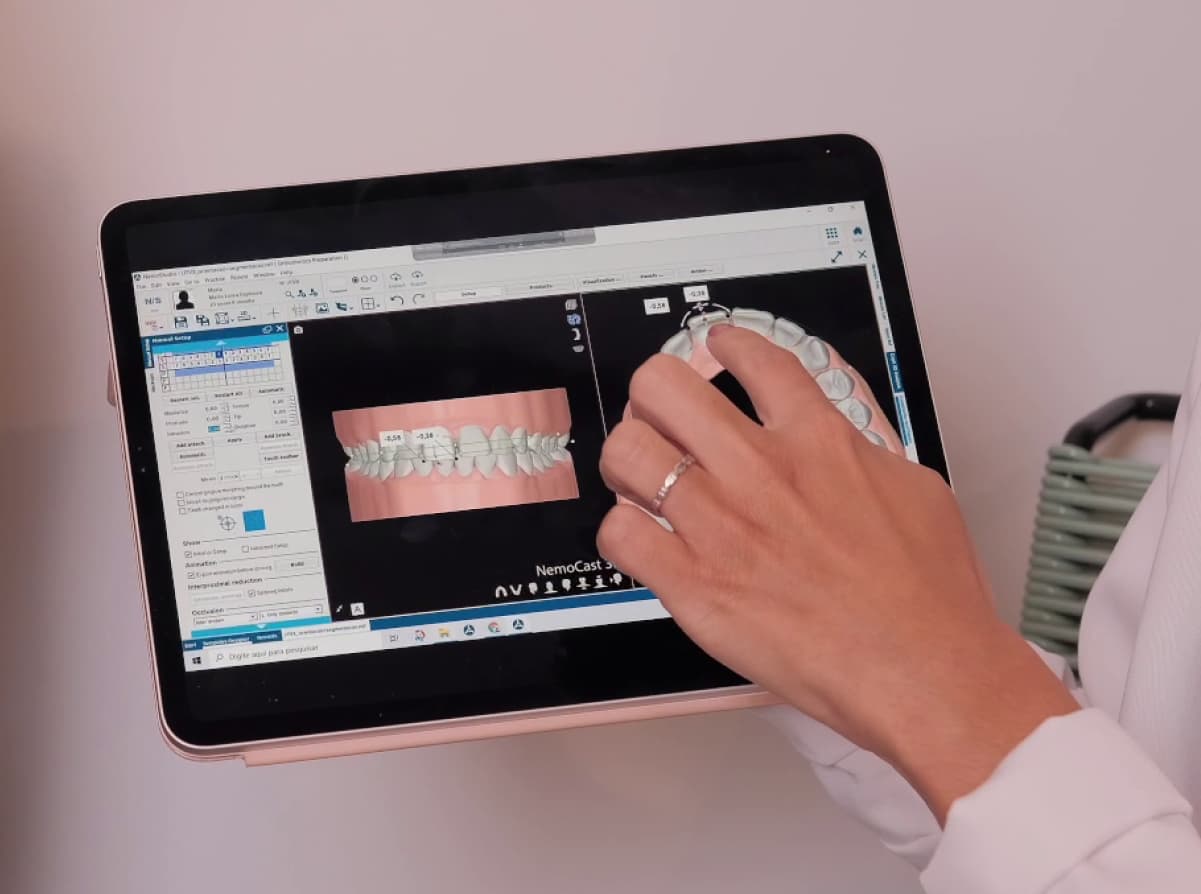 Dentistas em uma vídeo chamada planejando um caso de um paciente SouSmile