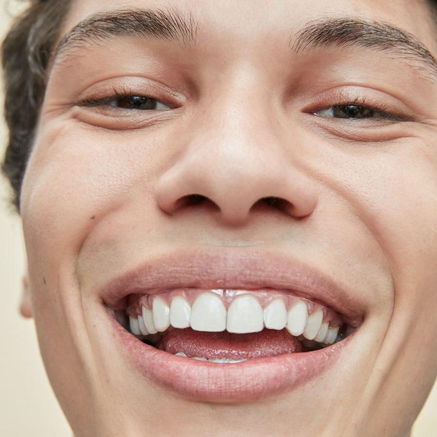 homem sorrindo com aparelho transparente