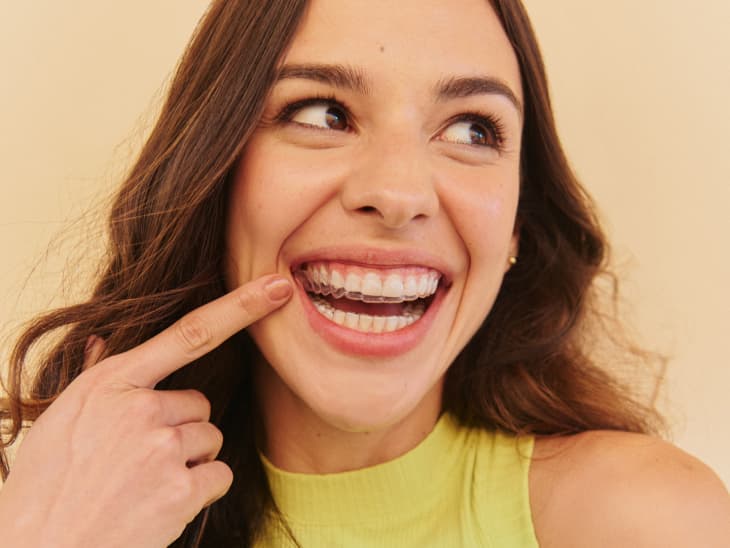 Mulher sorrindo com o alinhador transparente SouSmile